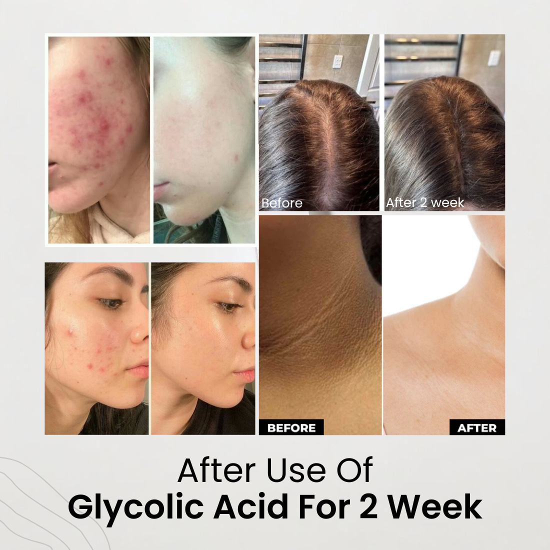 Glycolic Acid 7% Toning Solution