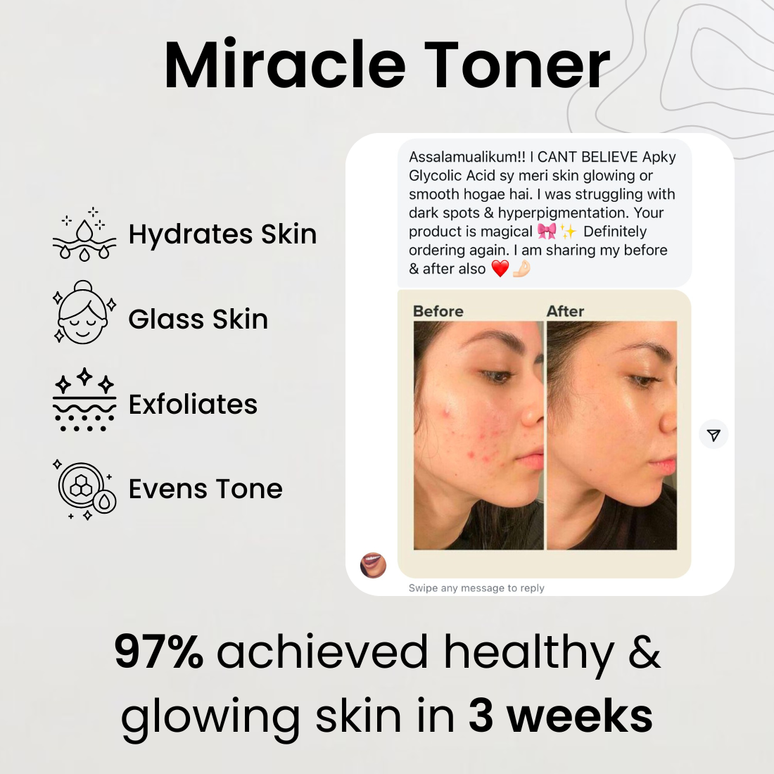 Glycolic Acid 7% Toning Solution