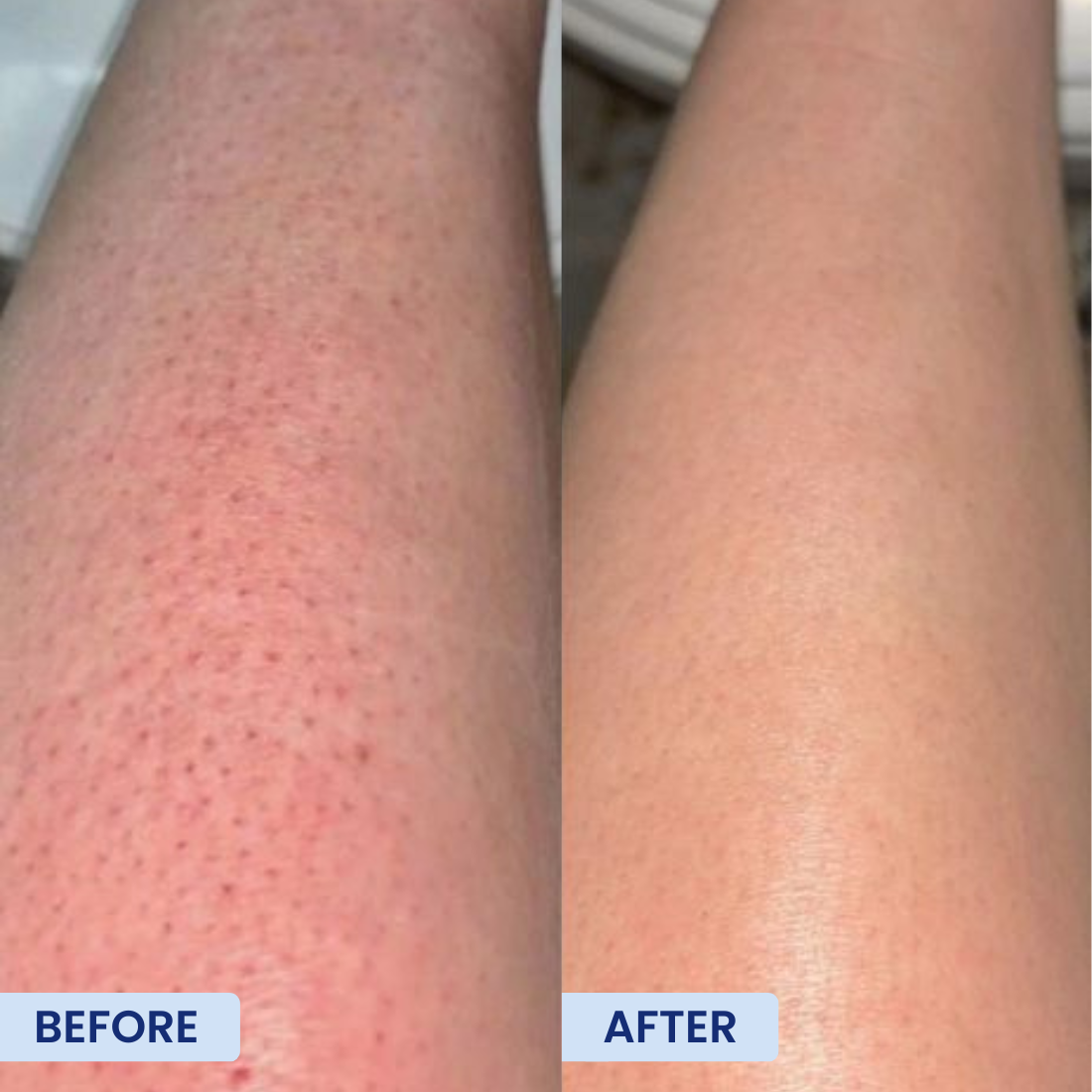 Lactic Acid 8% Toning Solution