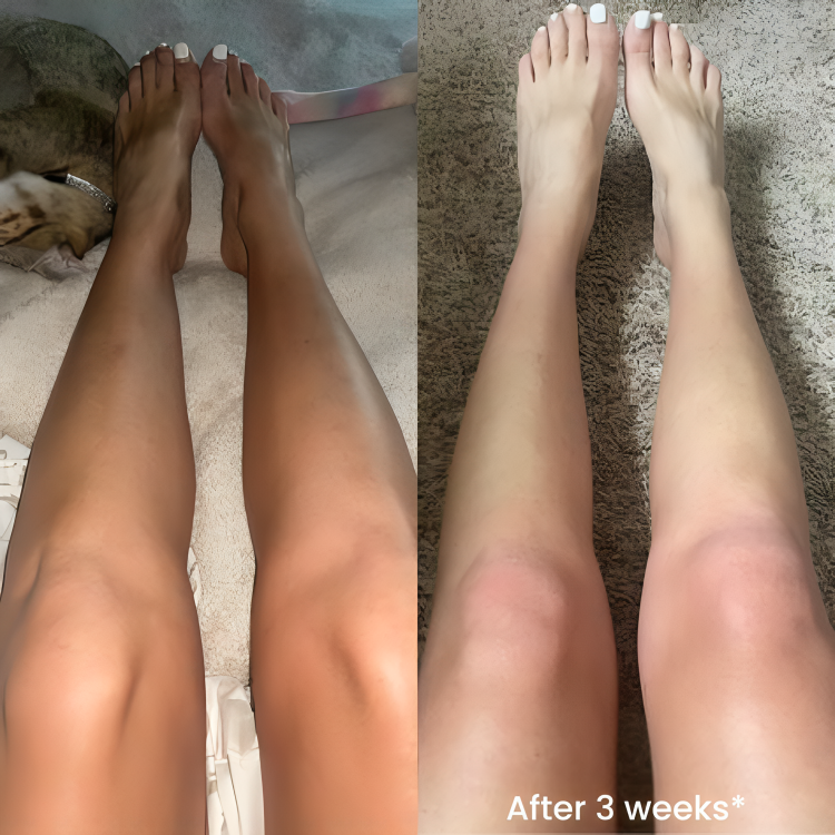 TONE BRIGHTENING DUO