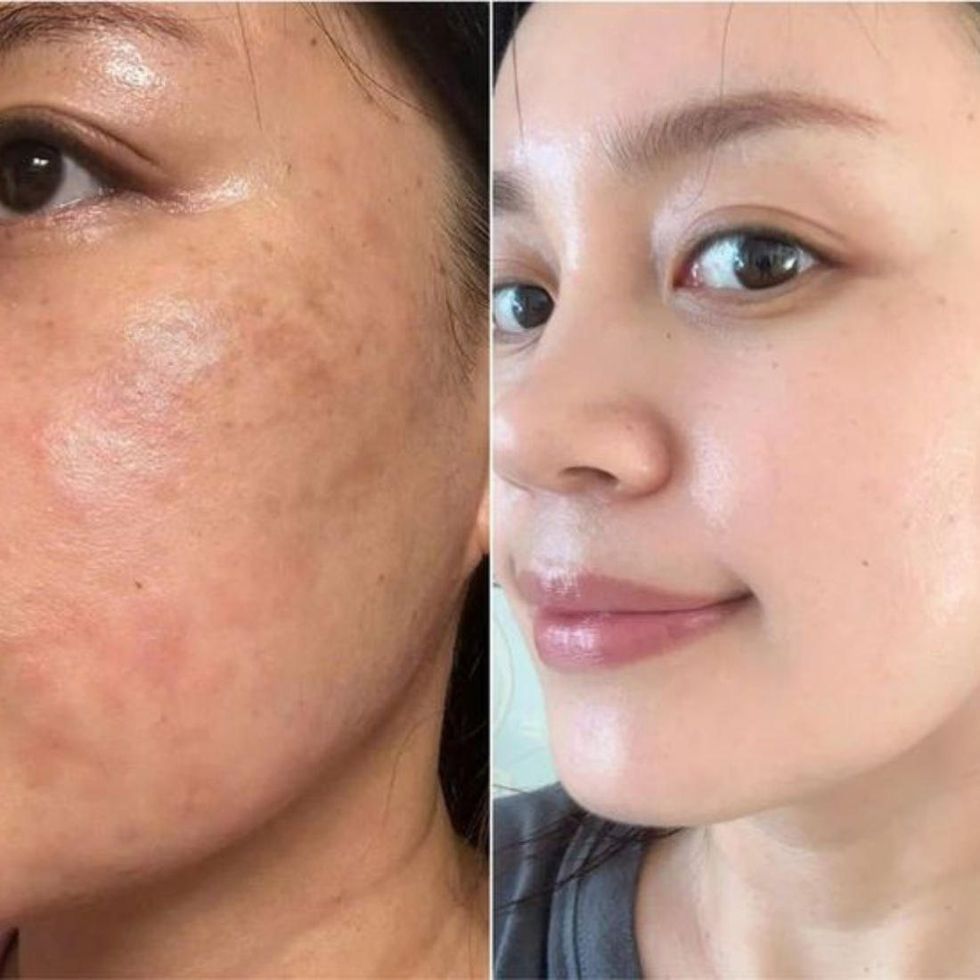 TONE BRIGHTENING DUO